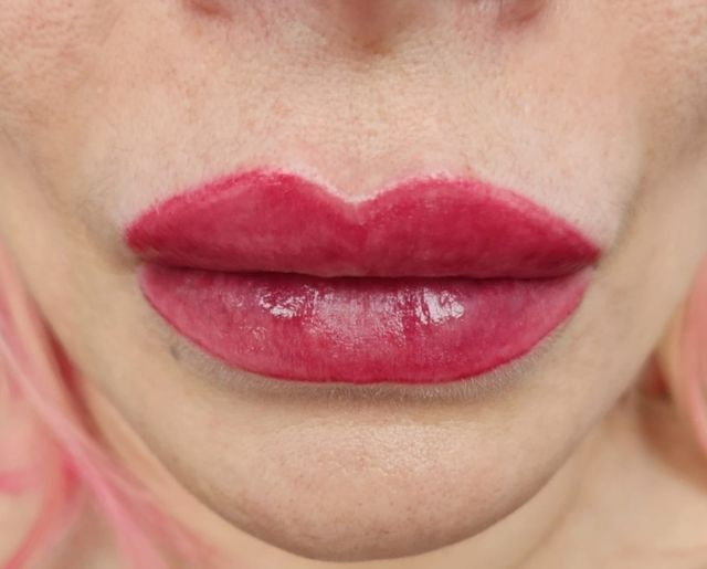 labios pigmentados